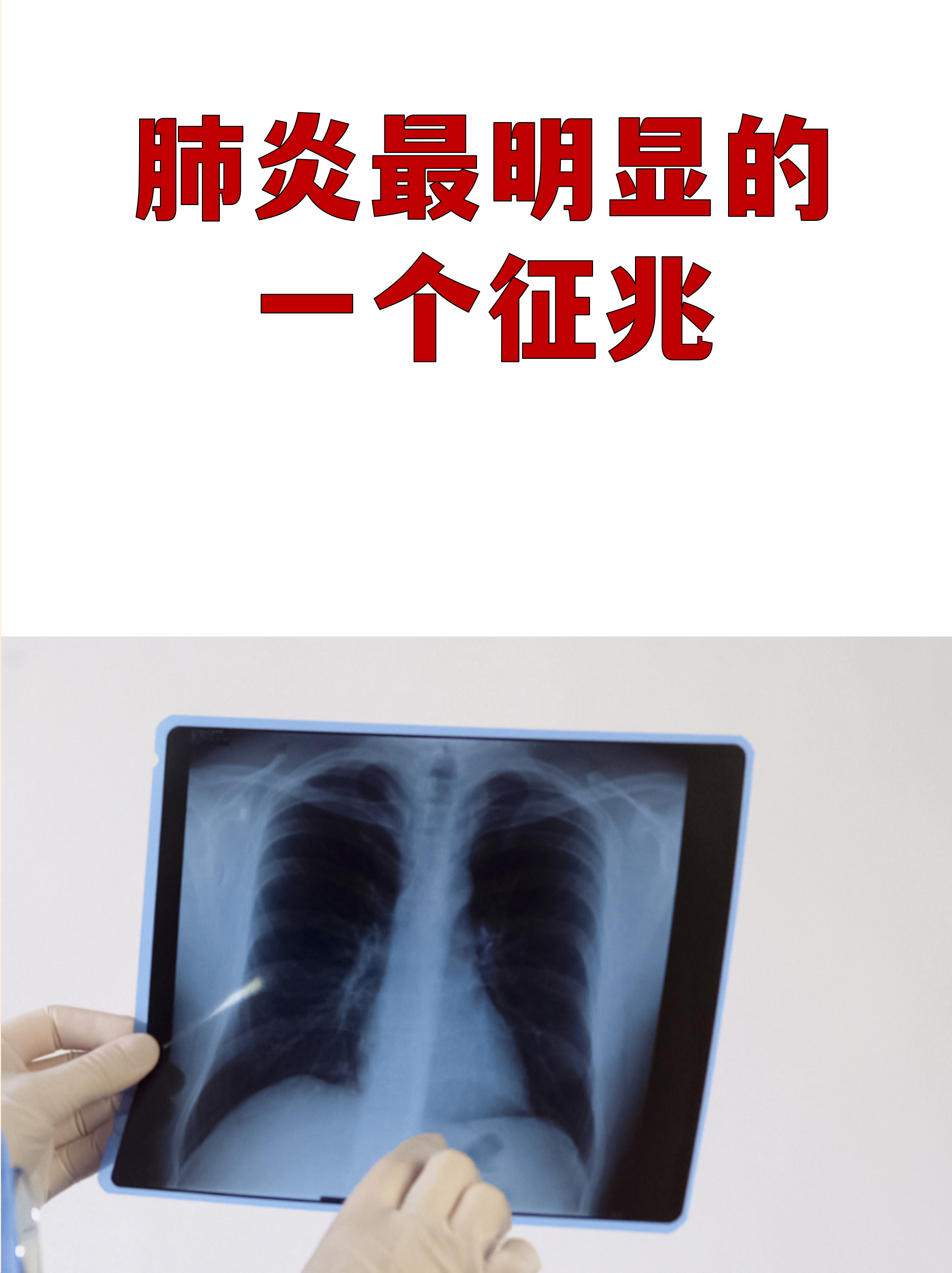 湖北零新增︰(湖北新增4823例新冠肺炎)-第1张图片