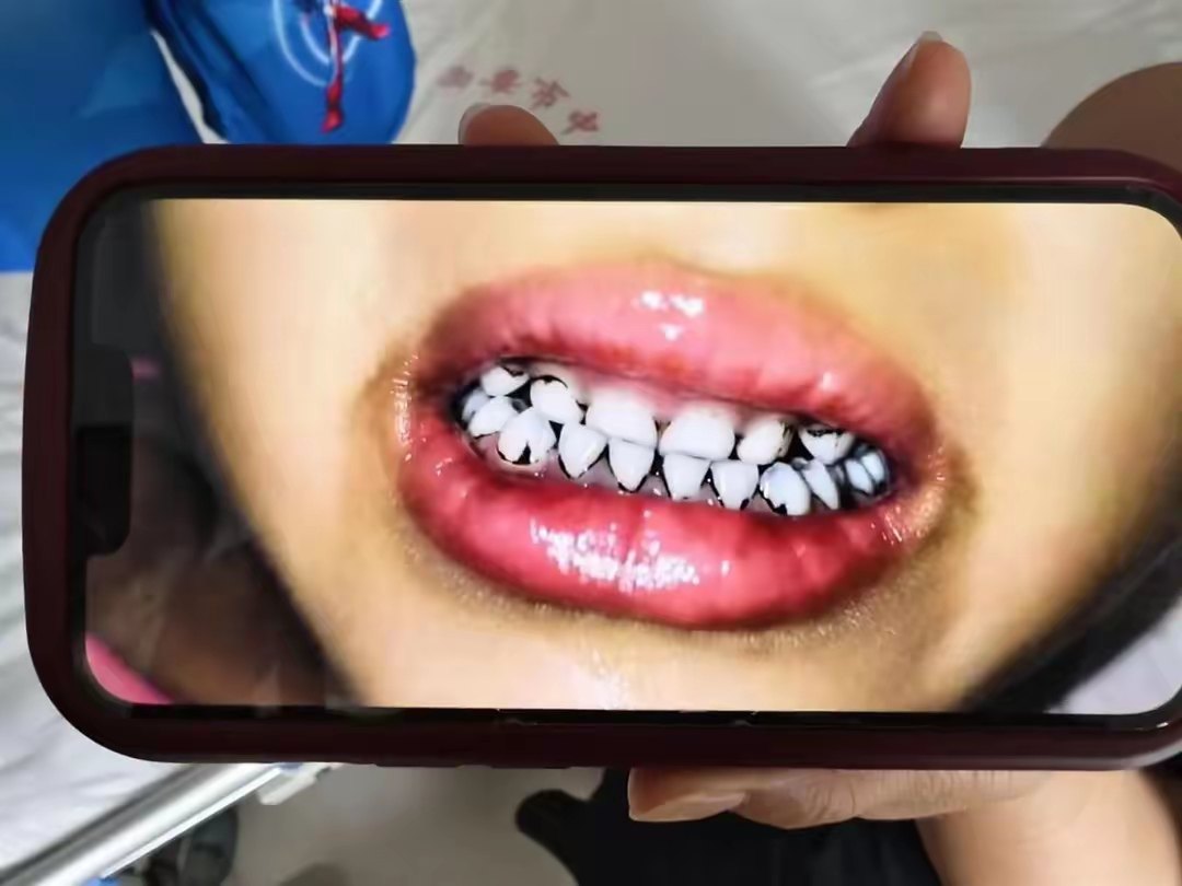 “西安确诊病例最新情况” 西安确诊疫情?-第2张图片