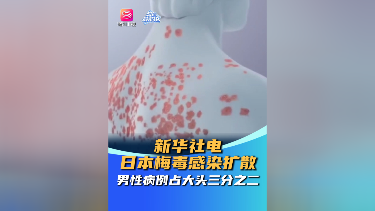 上海感染者日增近千-上海感染案例