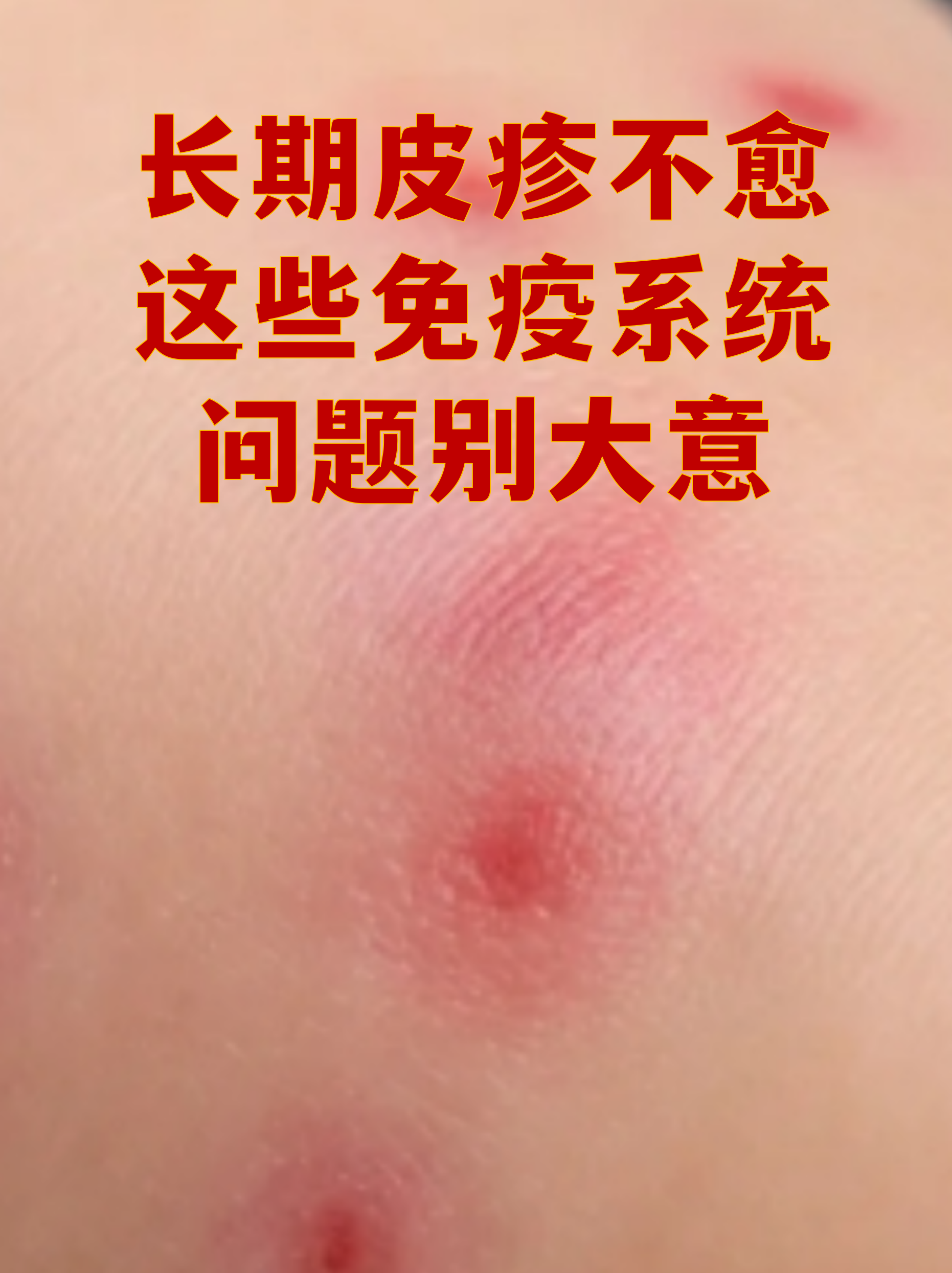 新疆新增无症状感染者240例︰(新疆新增137例无症状感染者 m由来cn)-第2张图片